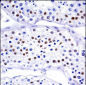 UBA1 Antibody (N-term)