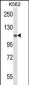 UBA1 Antibody (N-term)