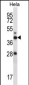 RAD23A Antibody (N-term)