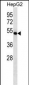 FDFT1 Antibody (C-term)