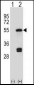 FDFT1 Antibody (C-term)