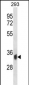 PPP6C Antibody (C-term)