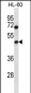 HAT1 Antibody (N-term)