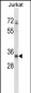 ART3 Antibody (C-term)