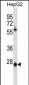 MEOX1 Antibody (Center)