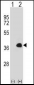 MEOX1 Antibody (Center)