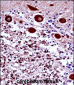 FREQ Antibody (N-term)