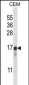 FREQ Antibody (N-term)