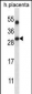 SIRT5 Antibody (Center)