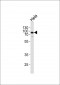 EWSR1 Antibody (C-term)