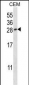 PGF Antibody (Center)