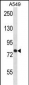 TRPC3 Antibody (C-term)