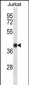 SET Antibody (N-term)