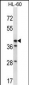 HSD3B1 Antibody (N-term)