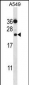 PSMD10 Antibody (C-term)