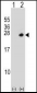 PSMD10 Antibody (C-term)