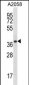 PSMA1 Antibody (C-term)