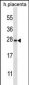 SNAP23 Antibody (C-term)