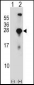 SNAP23 Antibody (C-term)