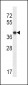 P2RY1 Antibody (Center)