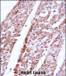 FST Antibody (C-term)