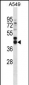 FST Antibody (C-term)