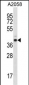 E2F3 Antibody (Center)