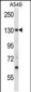 PSMD1 Antibody (N-term)