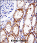 DNMT3A Antibody (Center R478)