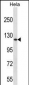 DNMT3A Antibody (Center R478)