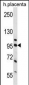 NCL Antibody (Center P291)