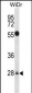 MED6 Antibody (Center)