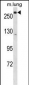 LRP5 Antibody (C-term)