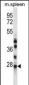 NQO2 Antibody (N-term)