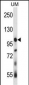 USP4 Antibody (N-term)