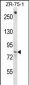 BACH1 Antibody (C-term)