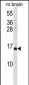 VAMP3 Antibody (Center)