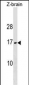 VAMP3 Antibody (Center)