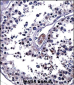 IL25 Antibody (Center)