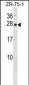 IL25 Antibody (Center)