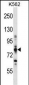 CPT1A Antibody (C-term)