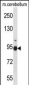 FBLN1 Antibody (C-term)