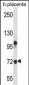FBLN1 Antibody (C-term)
