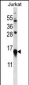 MYL9 Antibody (C-term)