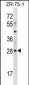 MSX2 Antibody (Center)