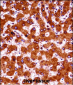 UBE4A Antibody (Center)
