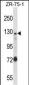 UBE4A Antibody (Center)