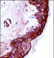 KLK9 Antibody (Center)