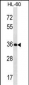 KLK9 Antibody (Center)