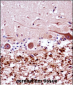 FANCG Antibody (C-term)